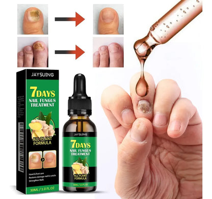 SERUM PARA HONGOS DE LAS UÑAS